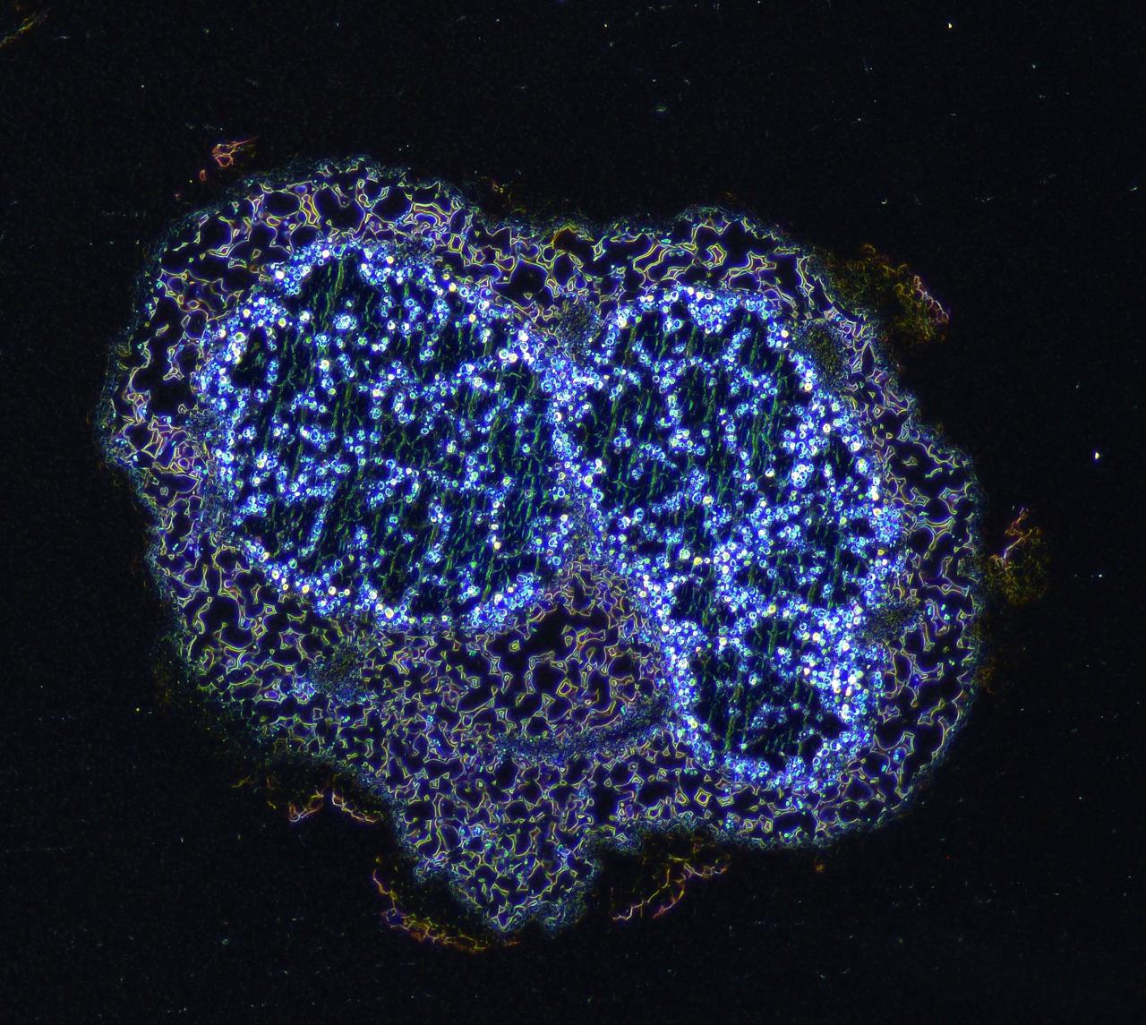 Cross-section of a P. mediterranea nodule